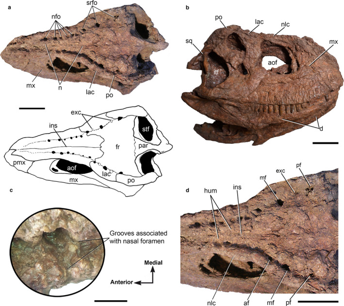 Skull of Skorpiovenator bustingorryi (MMCh‐PV 48) in dorsal view (a); Close up of the of the skull dorsal aspect showing the dorsal foramina (b); skull of Skorpiovenator in right lateral view (c); and, detail of a foramen with associated neurovascular grooves (d). Interpretive draw in (a) shows the position of the nasals in red. Arrows in (d) indicates anatomical orientations. Abbreviations: af, anterior foramen; aof, antorbital fenestra; d, dentary; exc, excavations; fr, frontals; hum, hummocky