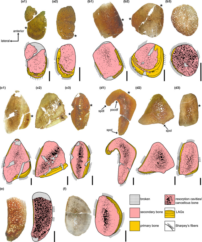 Transversal sections of hyperelongate hemispinous processes of Amargasaurus cazaui MACN PV N1A (a‐e) and Dicreosauridae indet. MOZ‐Pv 6126–1 (f). Each image of the complete section is accompanied by a schematic drawing showing the main histological features. For simplification, the position and orientation of Sharpey's fibres are indicated outside the section scheme. Asterisks indicate the position where bone modelling is evident (e.g. presence of reversal lines). (a) Proximal (a.1) and mid (a.2