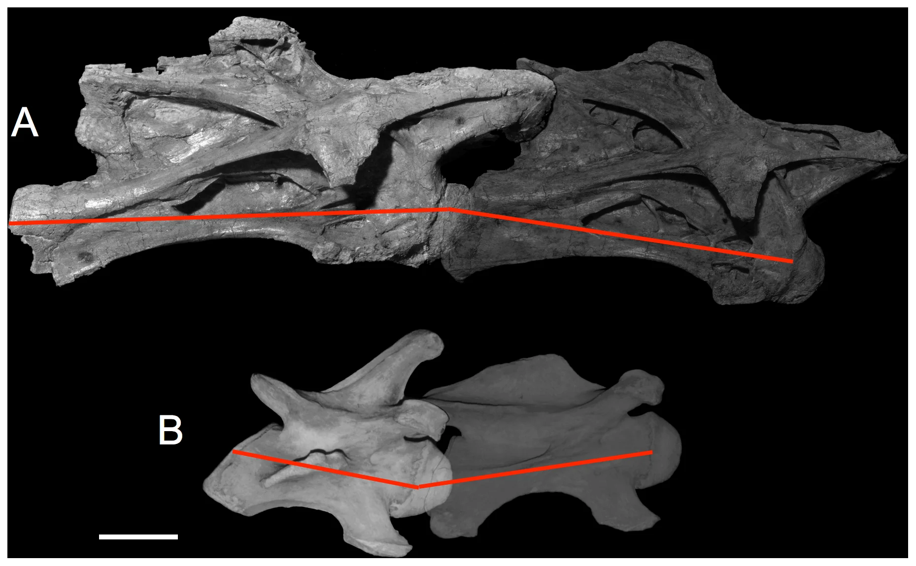Figure 1. Intrinsic neck curvature starts with the bones.