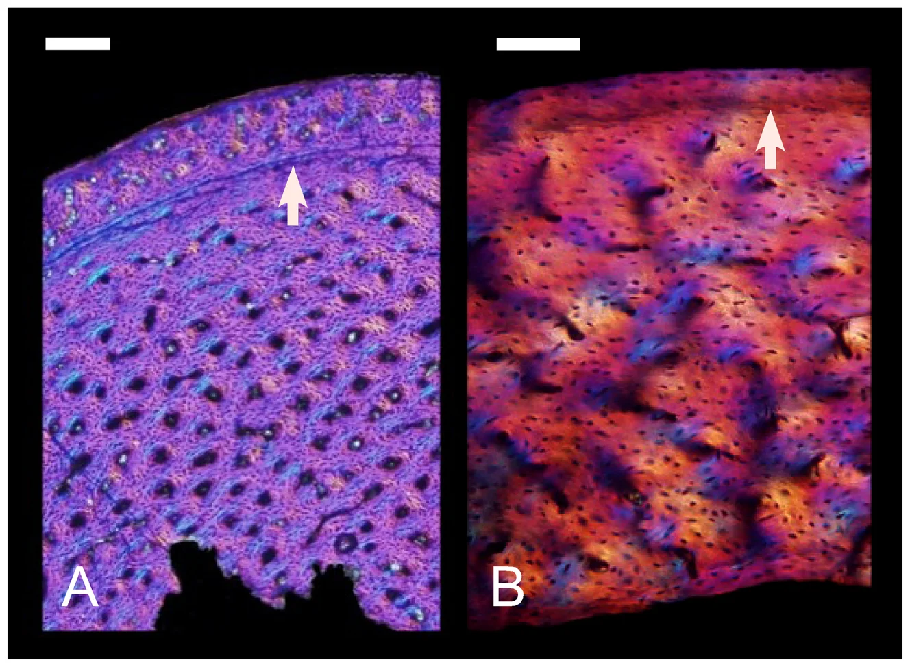 Figure 1. Long bone histology of a non-avialan dinosaur and a Mesozoic bird viewed with polarized microscopy.