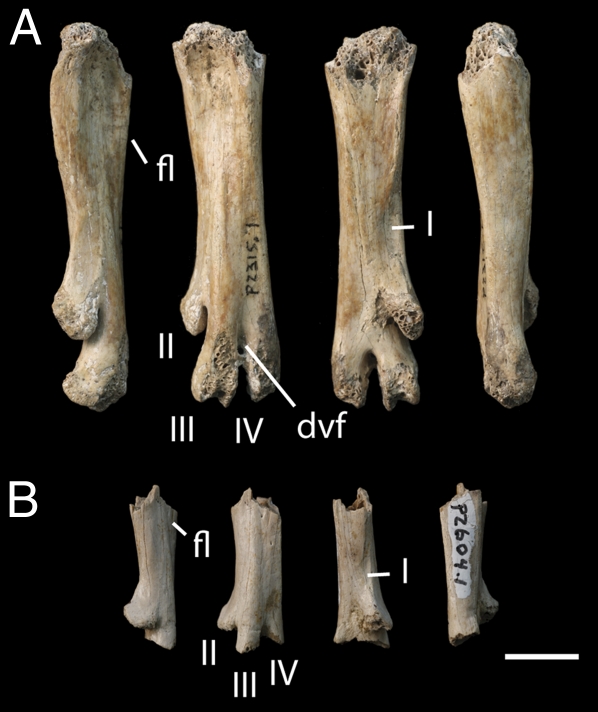 Tarsometatarsi of Hesperornithes from the late Maastrichtian of western North America. Left tarsometatarsi in medial, dorsal, plantar, and lateral view. ( A ) Hesperornithiform A RSM P2315.1. ( B ) Hesperornithiform B RSM P2604.1. I, facet for metatarsal I; II, metatarsal II; III, metatarsal III; IV, metatarsal IV; dvf, distal vascular foramen; fl, dorsal flange of metatarsal IV; RSM, Royal Saskatchewan Museum. (Scale bar, 1 cm.)