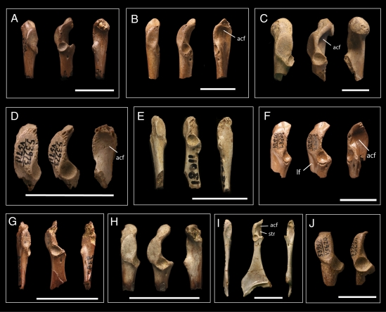Coracoids of derived Ornithurae from the late Maastrichtian of western North America. Left coracoids and right coracoids reversed for comparison. ( A ) Ornithurine A UCMP 53963. ( B ) Ornithurine B UCMP 129143. ( C ) Ornithurine C SDSM 64281. ( D ) “ Cimolopteryx” maxima UCMP 53973. ( E ) Ornithurine E AMNH 13011. ( F ) Ceramornis major UCMP 53959. ( G ) “ Cimolopteryx” minima UCMP 53976. ( H ) “ Cimolopteryx” petra AMNH 21911. ( I ) Cimolopteryx rara YPM 1805. ( J ) Ornithurine F UCMP 53957. ac
