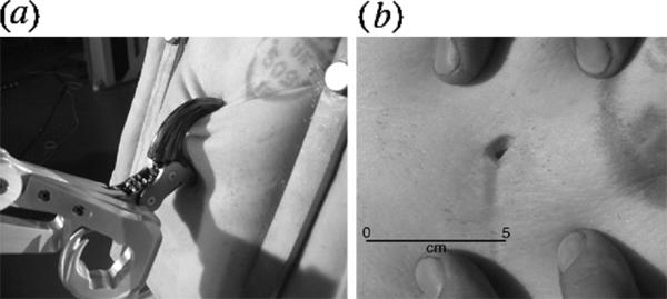 ( a ) Claw caused flesh ventral to the impact to bunch together, preventing the claw from sliding out of the wound. ( b ) Entry/exit wound produced in fleshy substrate by composite claw. Scale bar, 5 cm.