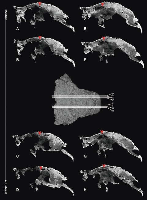 Sagittal sections of a Euoplocephalus skull (AMNH 5405) from CT data of Witmer & Ridgely (2008) show a tunnel within the frontal bone, laterally positioned and passing medially and slightly posteriorly on both sides. The most lateral sagittal section for each side is where the canal disappears into the bone. Arrowhead indicates the tunnel within the frontal, and letters A–H indicate the levels of the CT slices on the skull. Anterior is to the right in all CT slices and in the 3D model of the sku