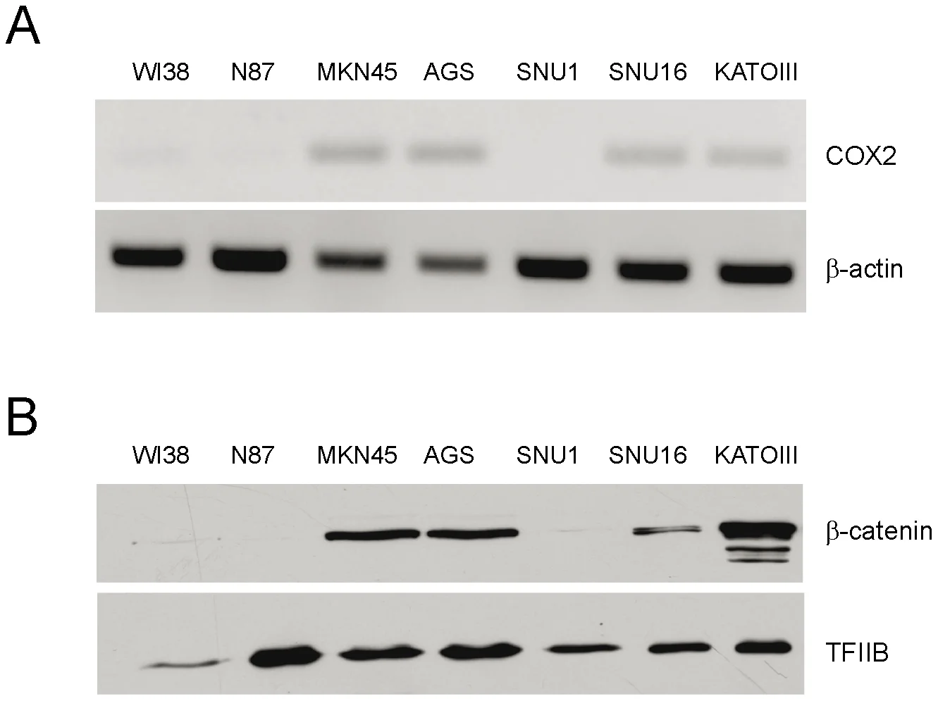 Figure 1. COX2 gene expression and nuclear localization of β-catenin in GC cells.