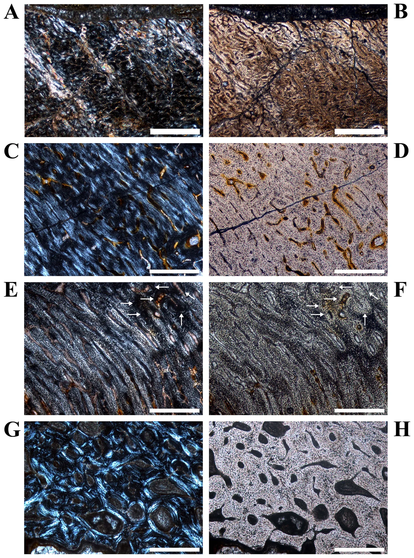 Figure 2. Details of cross sections of Dysalotosaurus femora showing resorption and bone tissue types.