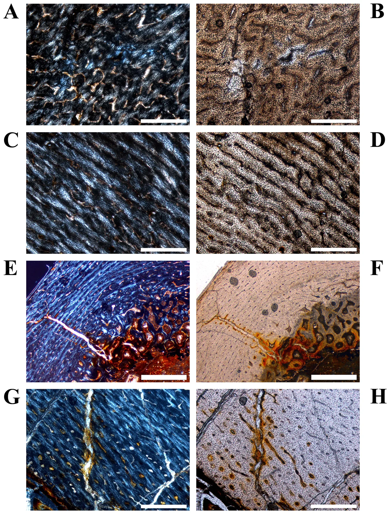 Figure 3. Variation of vascular organization in cross sections of Dysalotosaurus femora.