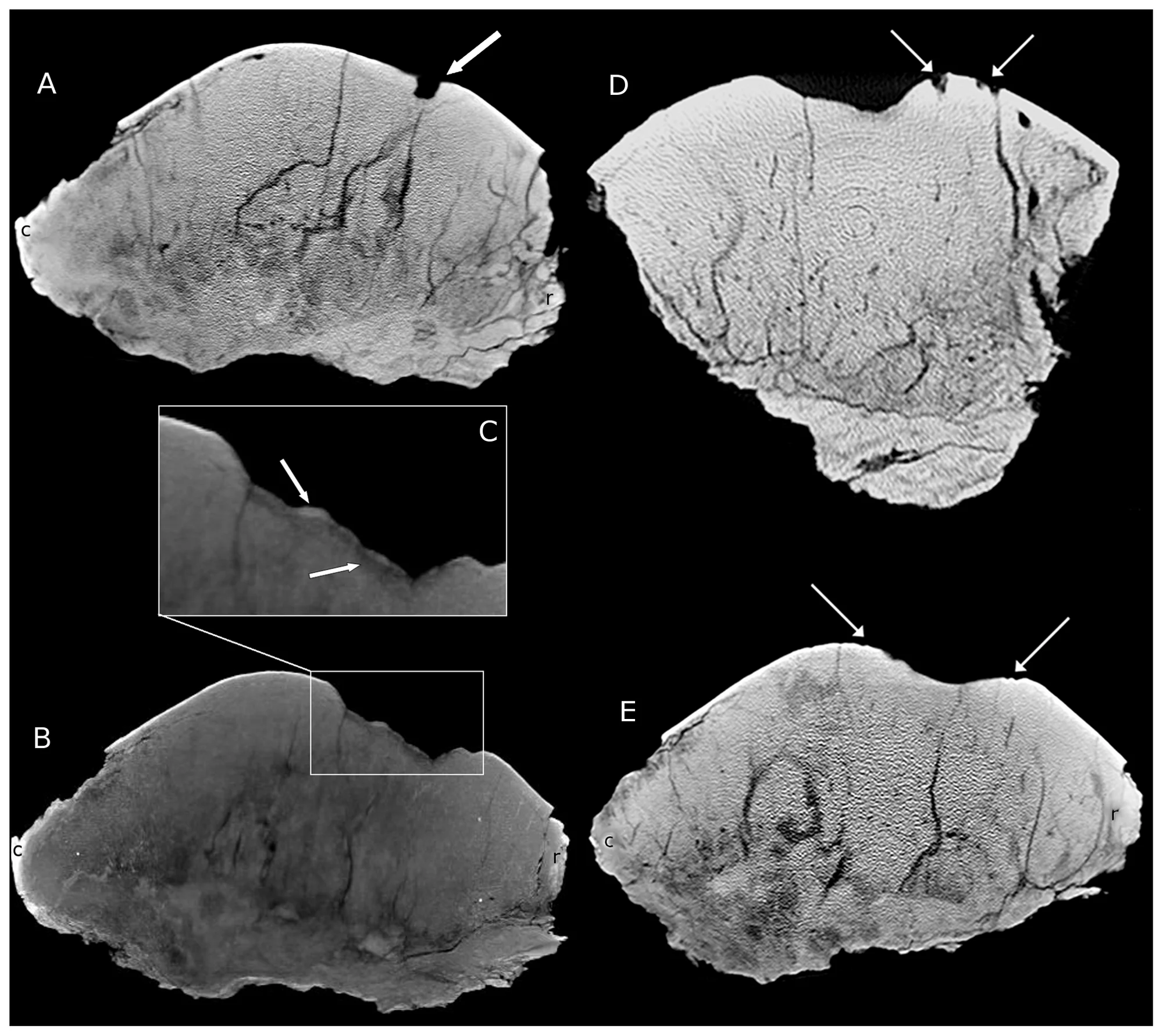 Figure 3. CT images of BMR P2001.4.5.