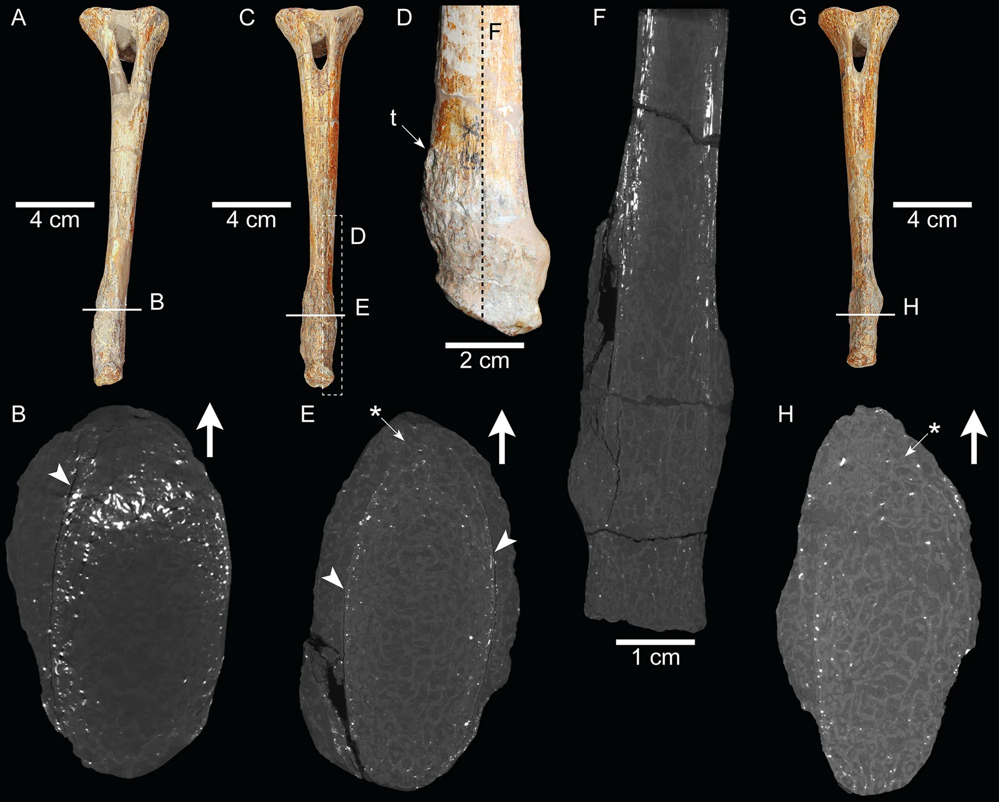 Fig 2. Pathological chevrons of SMNS 13200.
