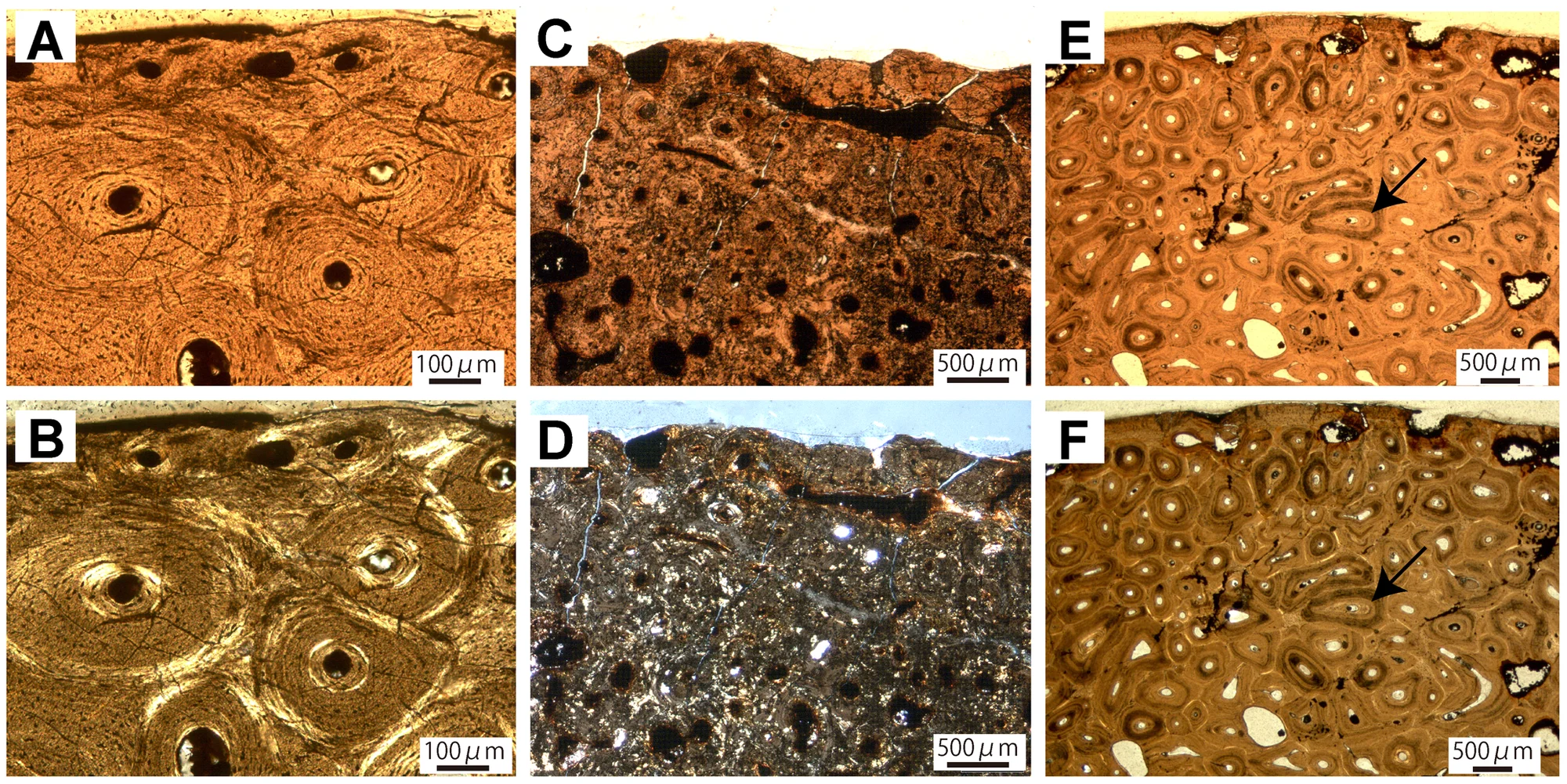 Figure 3. Long bone histology of Ankylosauridae indet.